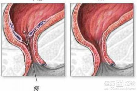 缤纷土豆泥烤虾的做法‘三亿体育手机版’(图2) 三亿体育手机版